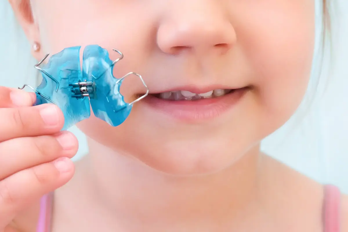 Palatal Expander Device (PED)
